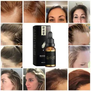 Plaukų Augimo Esmė Naftos Greitą Plaukų Augimą, Kovos su Plaukų Slinkimas Gydymo, Plaukų Priežiūros Produktai, Tirštiklis Plaukų Augimo Serumas Moterys Vyrai