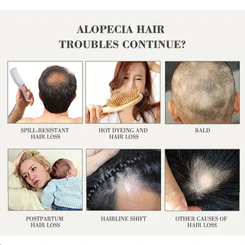 Plaukų Augimą eterinis Aliejus, Plaukų slinkimo Gydymas, užkirsti Kelią Plaukų Slinkimas Skysčio Pažeistų Plaukų Remonto Skatinti Plaukų Auginimo 30ml