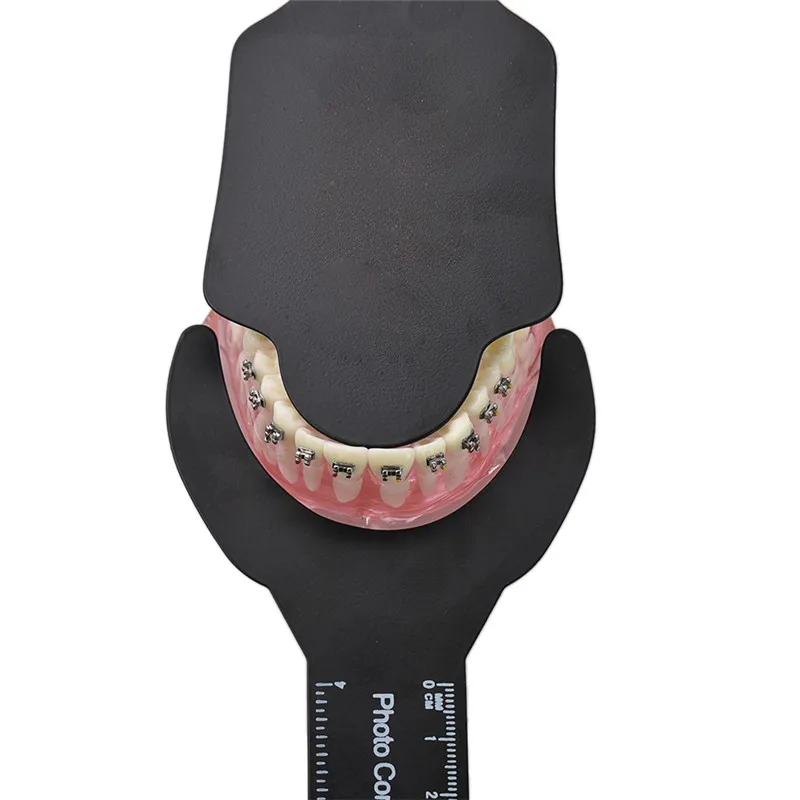 6pcs Dantų Ortodontinis Juodas Fonas Foto Vaizdo Kontrastas Valdybos Žodžiu Skruosto Plokštė su Skale Ženklas, Autoclavable Stomatologas Įrankiai